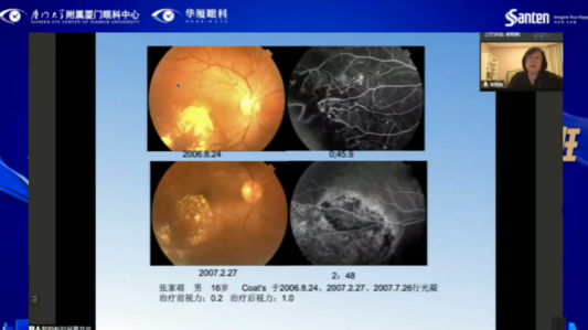 高峰论道·云端荟萃 ▏万人同步在线，30余名大咖云集“第六届6686体育论坛斜视与小儿眼科新技术学习班暨小儿、眼视光分论坛”6.png